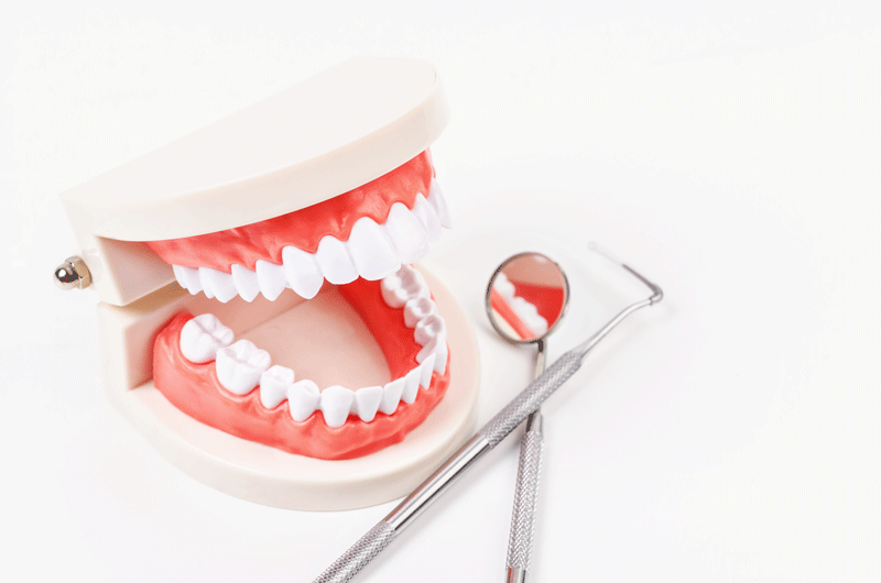 a full mouth dental implant model with dental tools.