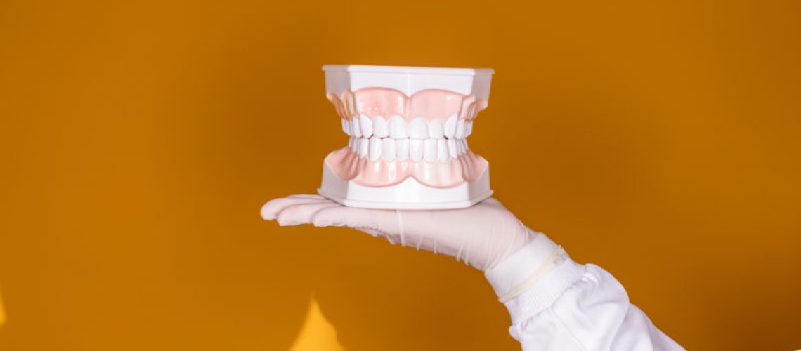 a full mouth dental implant model held up by a dentist.